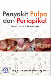 Image of PENYAKIT PULPA DAN PERIAPIKAL BESERTA PENATALAKSANAAN