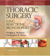 Image of Thoracic Surgery Lung resections, bronchoplasty